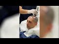 Our patients perfect hair transplant experience with dr can aesthetic