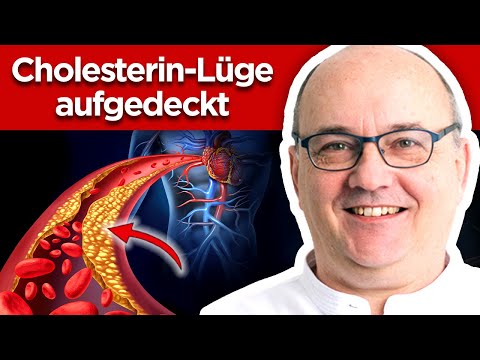 Cholesterin: Arzt enthüllt