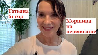 Лоб падает на переносицу? Морщина на переносице? Исправляем при помощи простой техники.