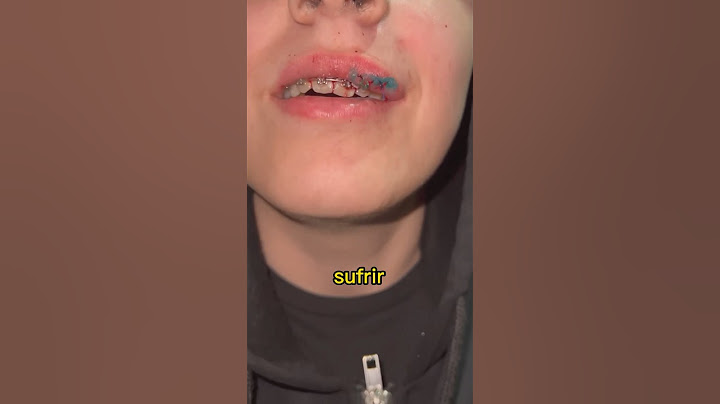 Los brackets pueden salvar tus dientes si tienes un golpe tan BRUTAL en la boca como este