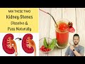 Drink This Once To DISSOLVE KIDNEY STONES and Pass Easily | Kidney Cleansing Drink