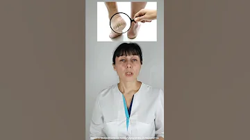 Трещины на пятках Частые причины #shorts