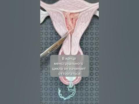 Что такое менструация? #shorts #гинеколог #врач #менструация - YouTube