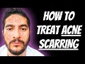 How to treat acne scarring 2024