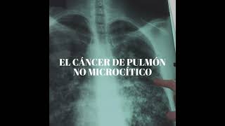 #DesdeElPrincipio | Cáncer de pulmón no microcítico en estadios iniciales screenshot 3