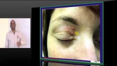 NEETPG Coaching Image Based MCQ