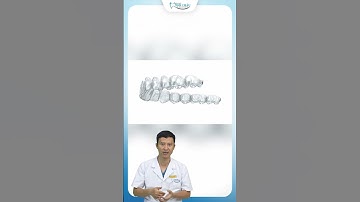 Niềng Răng Invisalign Có Hiệu Quả Không ? | Bác Sĩ Yên