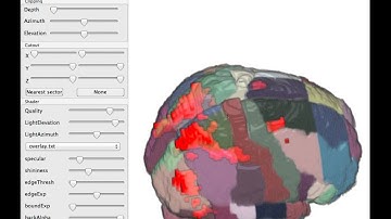 MRIcroGL atlas overlay