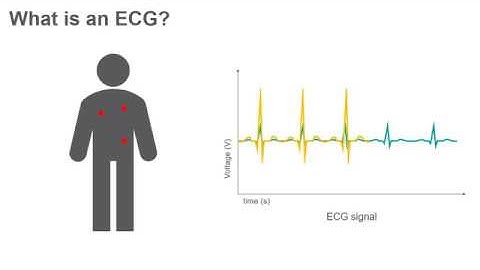 ECG Circuit - Project Lab #3