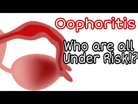 Video: Oophoritis Kronik - Rawatan, Tanda, Diagnosis
