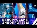 Белорусские врачи начали устанавливать отечественные эндопротезы коленного сустава. Панорама