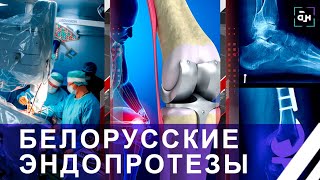 Белорусские врачи начали устанавливать отечественные эндопротезы коленного сустава. Панорама