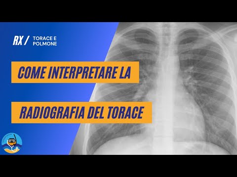 Video: Come leggere una radiografia del torace (con immagini)