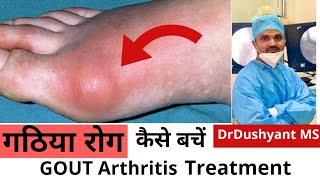 Gout Arthritis Treatment || How to prevent It  || गठिया या वात रोग के बारे में जानकारी|| DrDushyant|