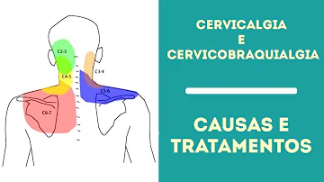 O que causa a síndrome Cervicobraquial?