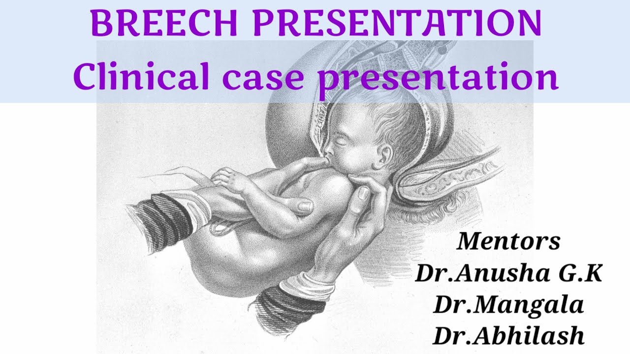breech presentation at the time of examination in hindi