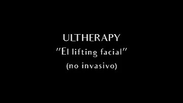 ¿Funciona Ultherapy en la papada?