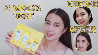 SOME BY MI YUJA NIACIN 30 DAYS BRIGHTENING SOLUTION 4-STEP KIT EDITION REVIEW