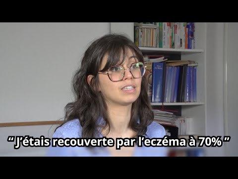 Recouverte d'eczéma :