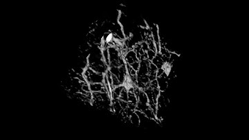 Knife-Edge Scanning Microscope (KESM): Cerebellar Purkinje cells