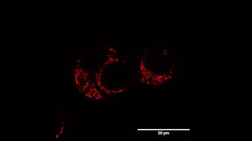 MTRed HeLa cells timelapse