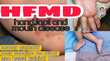 Rashes sa Kamay, Paa at bibig|Hand foot and mouth disease (HFMD)|Tagalog Explained|Dr. PediaMom
