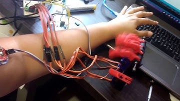 Myoelectric Prosthetic Hand with myoware sensor