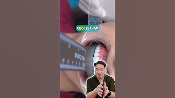 Thay đổi từng chiếc răng, đổi cả thần thái #drThu #BsThu #Dansuthammy #Veneer