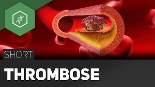 Trombosou def