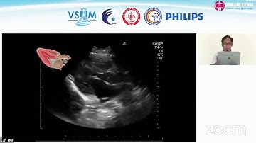 [CME 2022] 10 Siêu âm nhanh trong shock và hạ huyết áp (RUSH) - ThS.BS. Nguyễn Công Quỳnh