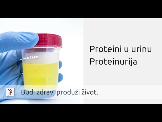 test urina za hipertenziju