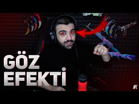 NAPERVAYS GİBİ EDİT