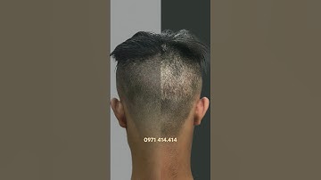 xăm tóc che sẹo phía sau do lấy tóc tự thân để  lại #xămtóc #scalp #hói_đầu  sẹo xấu