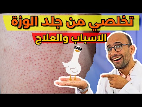 الخلاصة في جلد الوزة التقرن الشعري الاسباب والعلاج المثالي حقيقي مش وصفات  