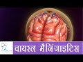 वायरल मैनिंजाइटिस और इसके प्रभाव