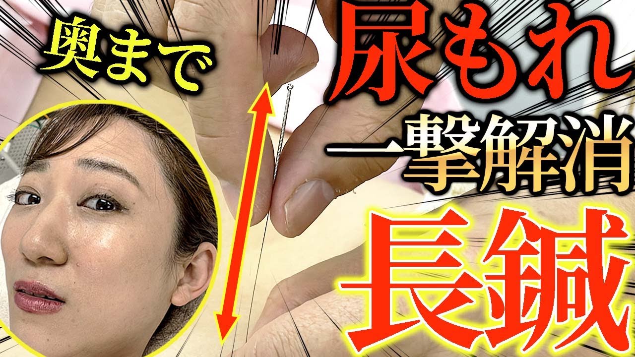 鍼治療 尿もれ】女性の尿もれの悩み 恥骨に長い鍼で治す モデルさんが
