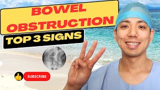 Do I have a small bowel obstruction? Top 3 signs for small bowel obstruction, and how to treat it.