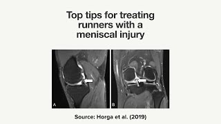Top tips for treating runners with a meniscal injury