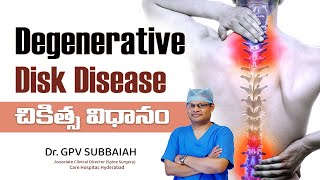 How is degenerative disk disease treated | Degenerative Disk Disease | Health video| Dr GPV Subbaiah