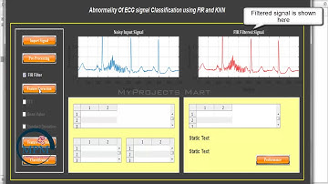 Abnormality Of ECG Signal Classification Using FIR and KNN in MATLAB