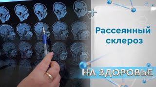 «На здоровье». Рассеянный склероз