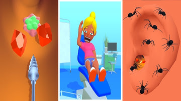 Earwax Clinic in Max Levels Mobile Game Walkthrough Update All Trailers iOS,Android Gameplay