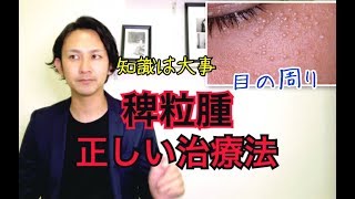 目の周りの 稗粒腫 はいりゅうしゅ に悩んでる方が知っておきたい治療法を紹介します Youtube