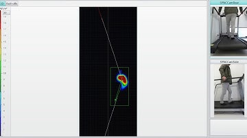 Gait Analysis - Zebris