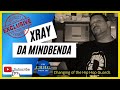 Capture de la vidéo Xray Da Mindbenda Exclusive Interview!