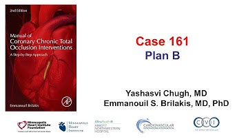 Case 161 - Manual of CTO PCI: Plan B