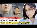 [SUB] Ultimate V-Line Face | Facial Bone Contouring Surgery in Korea | Cheekbone & Jawline Reduction