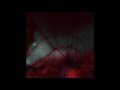 Miniature de la vidéo de la chanson Shamania (Dunkle Dummies Remix)