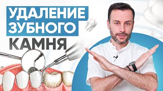 Удаление зубного камня. Причины зубных отложений и гигиена зубов