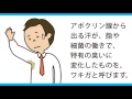 ワキガ？汗が特有の臭いに変化したものが「ワキガ(腋臭症)」